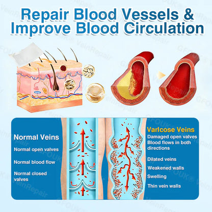 US✅🌱 VeinRepair Microneedle Patch Roll⚡Instant Relief, Long-Term Results
