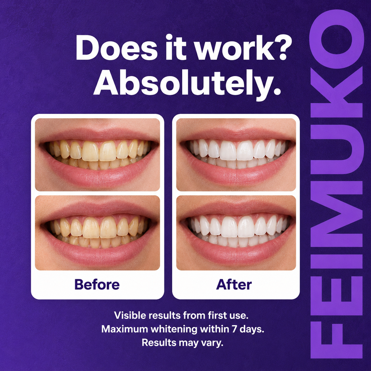 Feimuko Purple Teeth Whitening Strips