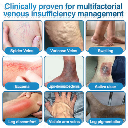 US✅🌱 VeinRepair Microneedle Patch Roll⚡Instant Relief, Long-Term Results