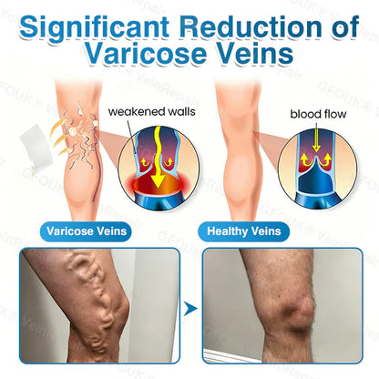 US✅🌱 VeinRepair Microneedle Patch Roll⚡Instant Relief, Long-Term Results