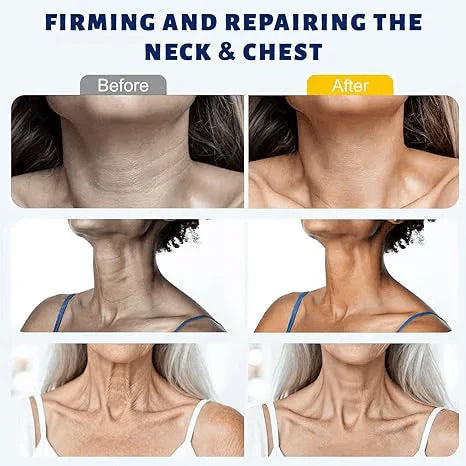 ✨Instant Neck Lift Cream — 🧴 Infused with Retinol & Hyaluronic Acid | Firms the Neck, Reduces Wrinkles & Double Chin