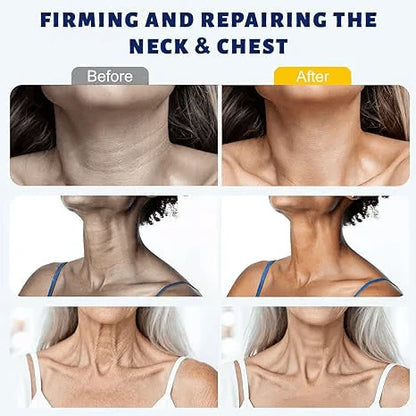 ✨Instant Neck Lift Cream — 🧴 Infused with Retinol & Hyaluronic Acid | Firms the Neck, Reduces Wrinkles & Double Chin