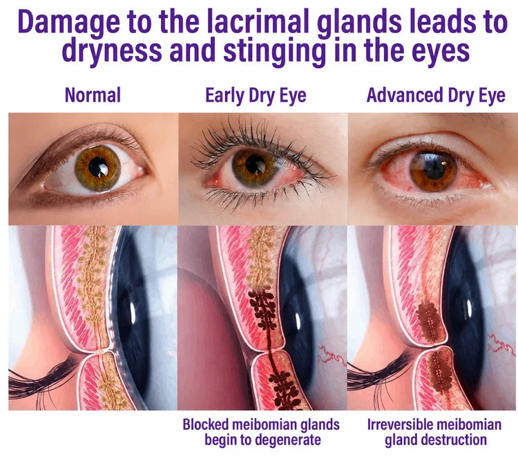 Transdermal Vision-Repair Eye Microneedle Patch